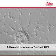 미분간섭 관찰법 Differential Interference Contrast (DIC) Microscopy)