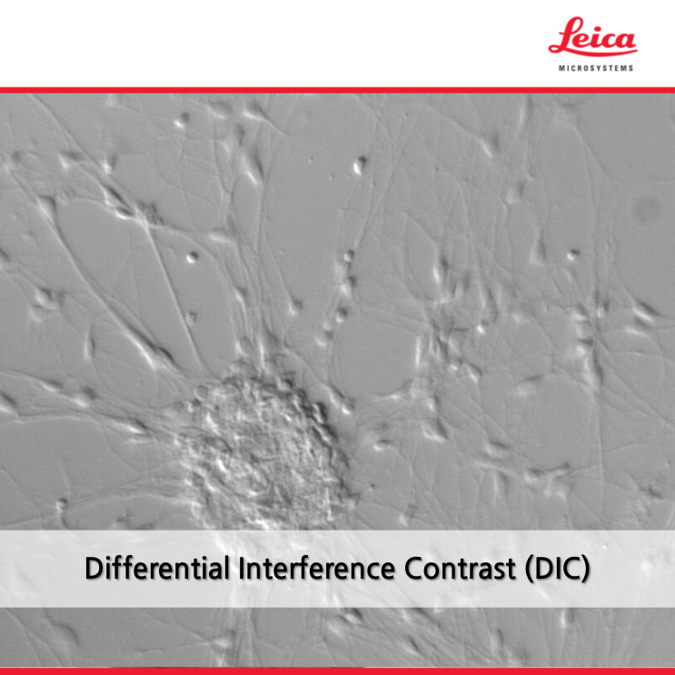 미분간섭 관찰법 Differential Interference Contrast (DIC) Microscopy) : 네이버 블로그