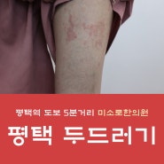 [미소로] 평택두드러기피부과에서 두드러기 원인 파악을 먼저