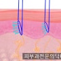 더마샤인(밸런스, 프로) 스킨부스터 주입 기기 - 삼성중앙역 피부과전문의 닥터림