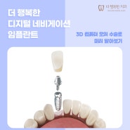 용산임플란트 어디서 해야 할 지 고민이라면? 3D 컴퓨터 모의 수술로 미리 알아보는 디지털 네비게이션 임플란트!