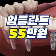 상봉역치과 꼭 확인해야 할 점은