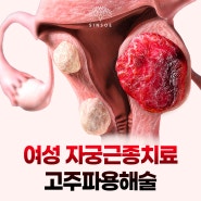 여성 자궁근종치료 고주파용해술