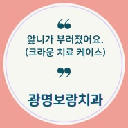 광명동치과, 광명보람치과, 부러진 앞니 심미보철로 치료해요.