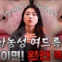 스트레스 유발....화농성 성인여드름, 참진한의원에서 해결하고 자신감도 같이 회복했습니다! (실제 환자 후기)