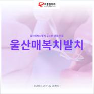 울산매복치발치 우수한 맞춤 진료