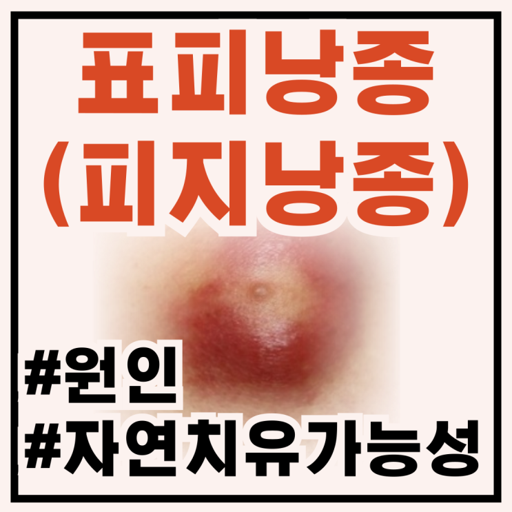 피지낭종(표피낭종) #1. 염증성 피지낭종 원인 및 자연치유 가능할까? : 네이버 블로그