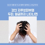 경산 지루성피부염 두피, 얼굴까지 나타나면