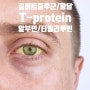 길버트증후군,황달/단백질 나는 적절히 잘 먹고 있나?피검사지 항목중 T-protein(총단백),Albumin(알부민),T-bilirubin(총빌리루빈)의 의미와 정상수치 관리방법.