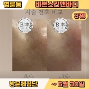 [모집] 방문체험단