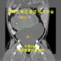 수원당수 말티즈 복강 종괴 수술 / 수원 강아지 종양 수술 / 화성24시동물병원 / 수원24시동물병원 / 수술전문동물병원