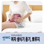 순천여의사산부인과 :: 여자 생식기 종기, 뾰루지 치료방법은 ?