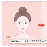 부천시청역 피부과, 실리프팅 잘하는 곳인지 구별하는 방법은?