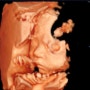 👶 임신후기 29주차-32주차 기록 (백일해후유증, 입체초음파)