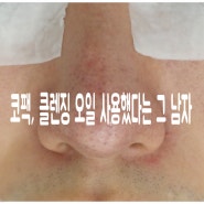 코팩, 클렌징 오일 사용했다는 그 남자