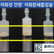 (강남어깨병원, 플래티넘의원) 극심한 어깨 통증, 어깨석회성건염. 의사도 치료 받는 비수술적 방법은?