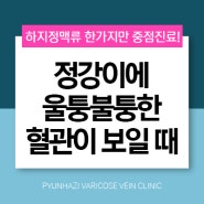 정강이 혈관이 울퉁불퉁 하지정맥류일 가능성