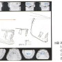 어린이 턱교정 관찰에 필수적인 하악골중첩 방법(안정골구조물 중첩법)