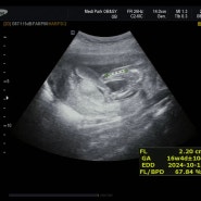 임신 중기 16~18주｜성별 확인, 철분제 복용 시작, 배 크기, 먹덧 임산부의 나날들, 증상