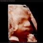 B22. 임신 28주-29주차 일상 및 증상 - 4D입체초음파, 햇빛병원 행복분만교실, 임산부운동, 집들이