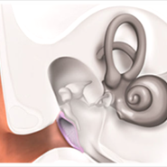 고막 찢어지면 증상 귀 질환 나타날 때 대처법