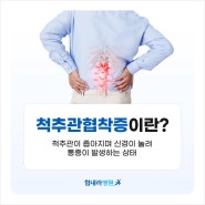 백세시대 척추협착증, 안전한 비수술적 치료 : 신경성형술과 풍선확장술