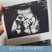임신16주차 태아성별시기 아기성별확인 기형아검사