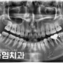 경주 사랑니 발치 잘하는 치과에서 안전하게 매복 사랑니를 제거해 드린 증례