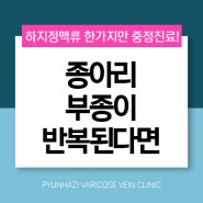 반복되는 종아리 부종 하지정맥류의 신호