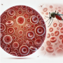 말라리아 경보? 여름철 모기 극성으로 다시 말라리아가 유행, 증상과 대처법, 좋은 음식은 무엇일까?