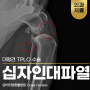 대형견 십자인대 파열 : 30kg 골든리트리버 TPLO 수술 후기, 대형견전방십자인대