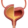 소변을 저장하고 배출하는 근육 기관 방광(bladder)