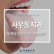 사우동치과 혀 백태 원인과 없애는 방법은?