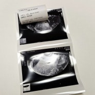임신일기 l 3주~4주 임신확인 아기집 임밍아웃 임신극초기증상