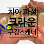 서울시청치과 치아 파절 크라운 구강 스캐너 활용!