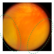 강아지 백내장 증상, 포도종, 맥락막 저형성 등을 부른 MOD(Merle ocular dysgenesis) 유전질환 진단