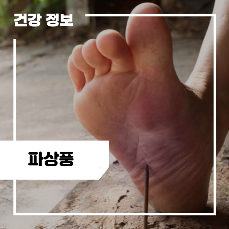 파상풍 초기증상 및 원인, 치료 방법, 성인 파상풍 예방접종 : 네이버 블로그