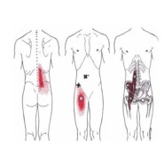 허리통증 이야기 : iliopsoas shortening