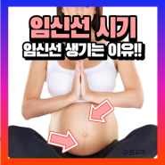 임신초기 증상 임신선시기 언제 임산부튼살 시기 튼살없애는법