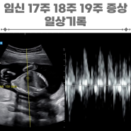 임신 17주 18주 19주 증상 일상기록