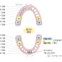송곳니 덧니가 유독 많은 이유 :: 치아 맹출 순서