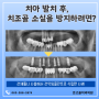 전주태평동임플란트, 치아 발치 후 치조골 소실을 방지하려면?
