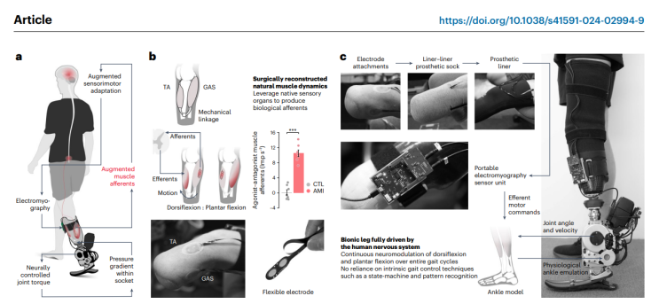 다리 절단 환자 희소식, 생체공학 인공다리 Bionic Limbs : 네이버 블로그