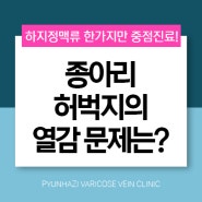 종아리 허벅지 열감 하지정맥류 확인해요