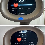 인모드대신 슈링크로 갈아탄이유: 강남슈링크 잘하는곳 추천