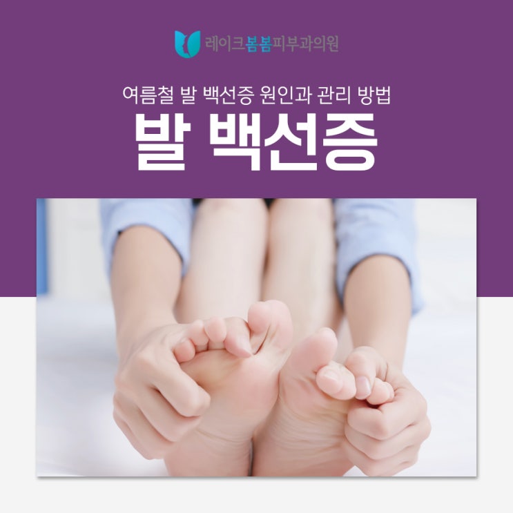 여름철 발 백선증 발생 원인과 관리 방법 : 네이버 블로그
