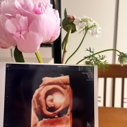 [임신일기🤰] 6주차 심장소리부터 8주차 젤리곰까지-!