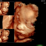 26-29w 임신일기 : 입체초음파 및 철분주사 맞기