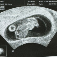8주 임신부 초음파보는날만 기다리기!