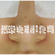 클렌징오일과 녹이는 제품 사용 후 생기는 부작용